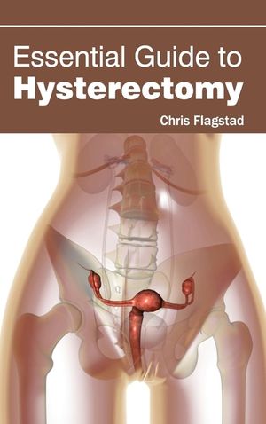 Essential Guide to Hysterectomy image number 0