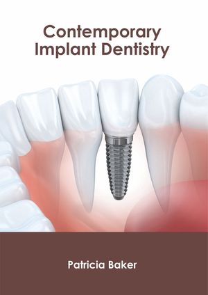 Contemporary Implant Dentistry image number 0
