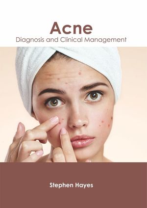 Acne: Diagnosis and Clinical Management image number 0
