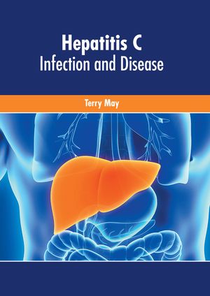 Hepatitis C: Infection and Disease image number 0