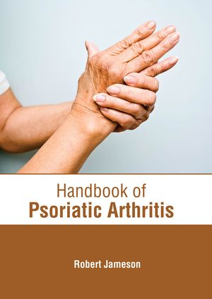 Handbook of Psoriatic Arthritis image number 0