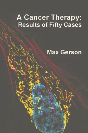 A Cancer Therapy: Results of Fifty Cases image number 0