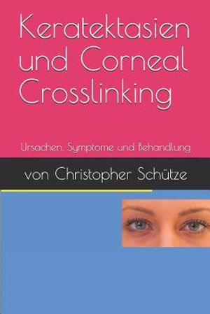 Keratektasien, Corneal Crosslinking: Ursachen, Symptome Und Behandlung image number 0