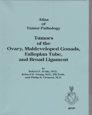 Tumors of the Ovary, Maldeveloped Gonads, Fallopian Tube, and Broad Ligament image number 0