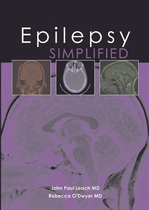 Epilepsy Simplified image number 0