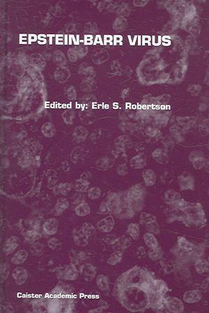 Epstein-Barr Virus image number 0