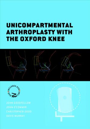 Unicompartmental Arthroplasty With the Oxford Knee image number 0
