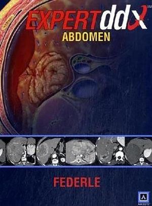 Expertddx: Abdomen: Published by Amirsys(r) image number 0