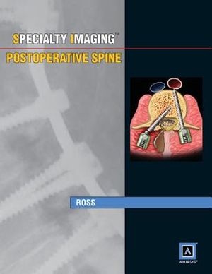 Specialty Imaging: Postoperative Spine: Published by Amirsys image number 0