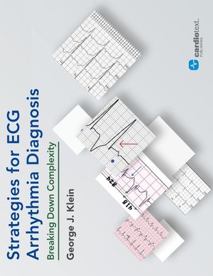 Strategies for ECG Arrhythmia Diagnosis: Breaking Down Complexity image number 0