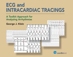 ECG and Intracardiac Tracings: A Toolkit Approach for Analyzing Arrhythmias image number 0