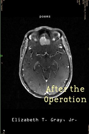 After the Operation image number 0