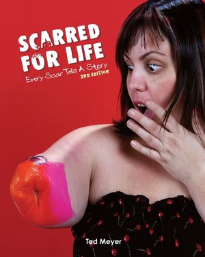 Scarred for Life. 2nd Edition: Every Scar Tells A Story image number 0