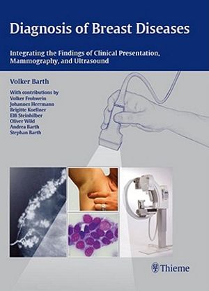Diagnosis of Breast Diseases: Integrating the Findings of Clinical Presentation, Mammography, and Ultrasound image number 0