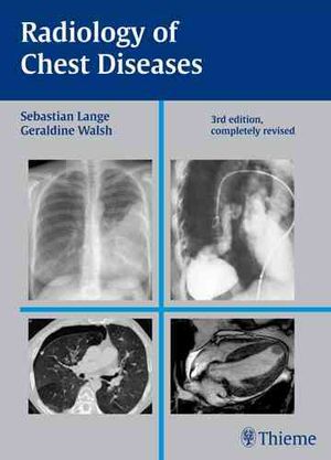 Radiology of Chest Diseases image number 0