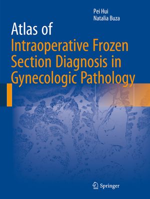 Atlas of Intraoperative Frozen Section Diagnosis in Gynecologic Pathology image number 0