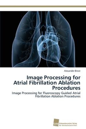 Image Processing for Atrial Fibrillation Ablation Procedures, Used ...