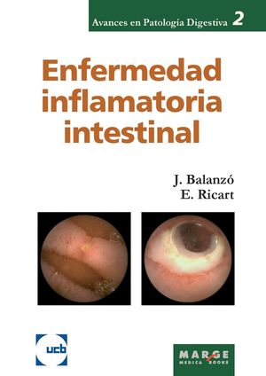 Enfermedad inflamatoria intestinal image number 0