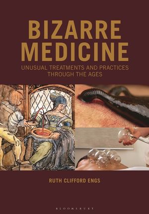 Bizarre Medicine: Unusual Treatments and Practices Through the Ages image number 0