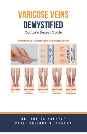 Varicose Veins Demystified: Doctor's Secret Guide image number 0