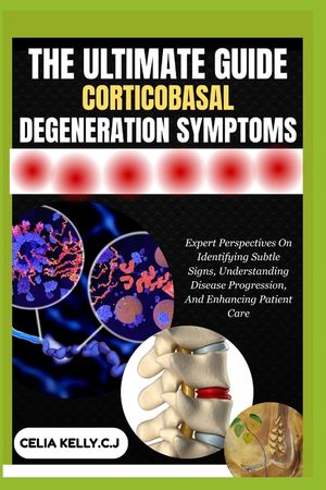 The Ultimate Guide Corticobasal Degeneration Symptoms: Expert Perspectives On Identifying Subtle Signs, Understanding Disease Progression, And Enhanci image number 0