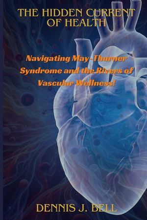 The Hidden Current Of Health: Navigating May-Thurner Syndrome and the Rivers of Vascular Wellness! image number 0