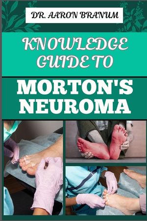 Knowledge Guide to Morton's Neuroma: Essential Manual To Symptoms, Diagnosis, Treatment, And Pain Relief For Foot Health And Nerve Pain Management image number 0