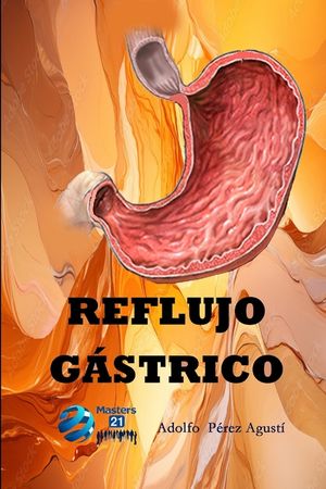 Reflujo g&aacute;strico image number 0