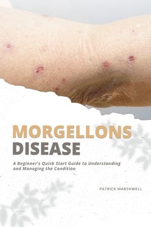 Morgellons Disease: A Beginner's Quick Start Guide to Understanding and Managing the Condition image number 0