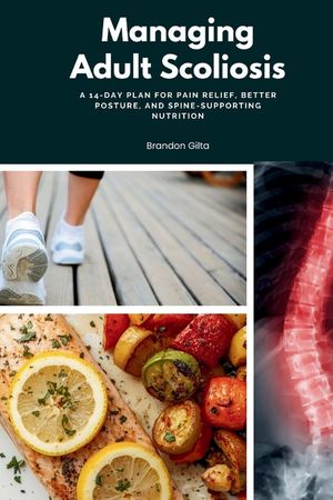 Managing Adult Scoliosis: A 14-Day Plan for Pain Relief, Better Posture, and Spine-Supporting Nutrition image number 0