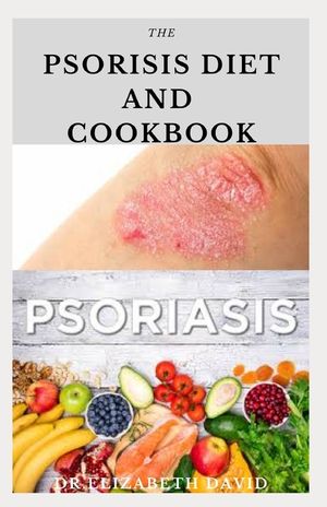 The Psoriasis Diet and Cookbook: Dietary Guide For Preventing and Healing Psoriasis: Includes Delicious Recipe, Meal Plan and Cookbook image number 0