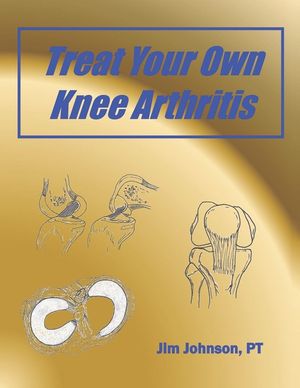 Treat Your Own Knee Arthritis image number 0