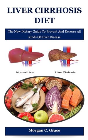 Liver Cirrhosis Diet: The New Dietary Guide To Prevent And Reverse All Kinds Of Liver Disease image number 0