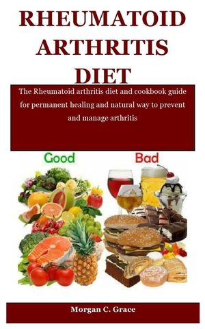 Rheumatoid Arthritis Diet: The Rheumatoid arthritis diet and cookbook guide for permanent healing and natural way to prevent and manage arthritis image number 0