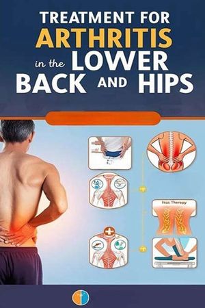 Treatment for Arthritis in the Lower Back and Hips: Learn about medications, procedures, therapies, and home remedies that can help you with lumbar an image number 0