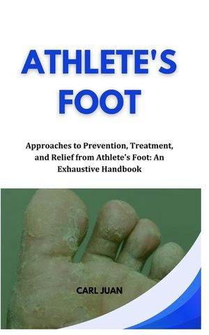 Athlete's Foot: Approaches to Prevention, Treatment, and Relief from Athlete's Foot: An Exhaustive Handbook image number 0
