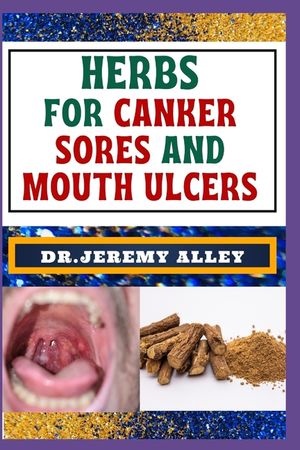 Herbs for Canker Sores and Mouth Ulcers: Soothing Remedies, Harnessing Wisdom To Relieve Nature's Bounty Through Effective Strategies image number 0